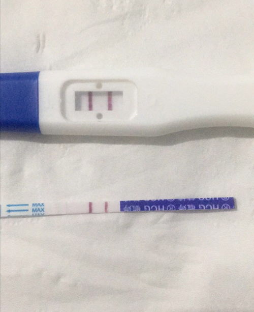 40歲還可以通過試管嬰兒生寶寶嗎？權(quán)威解答與注意事項(xiàng)